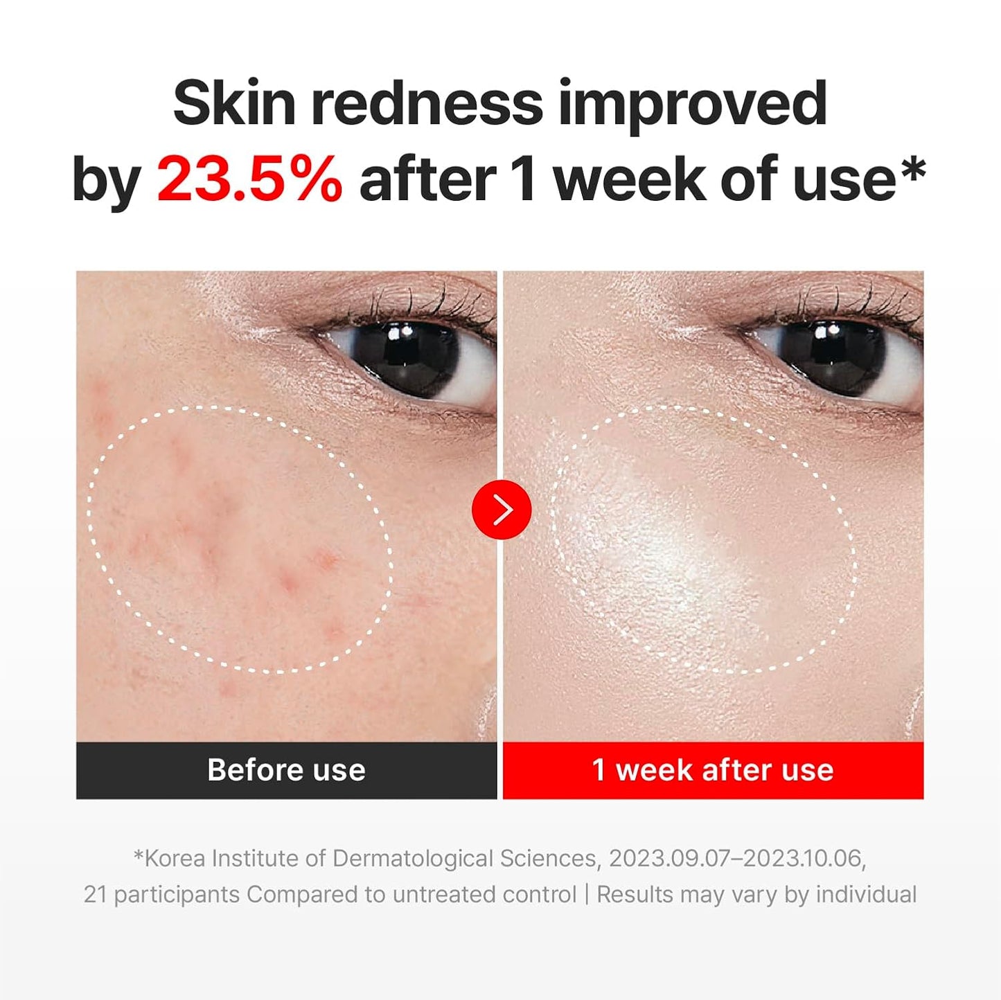 Centella Time Renewal Cream