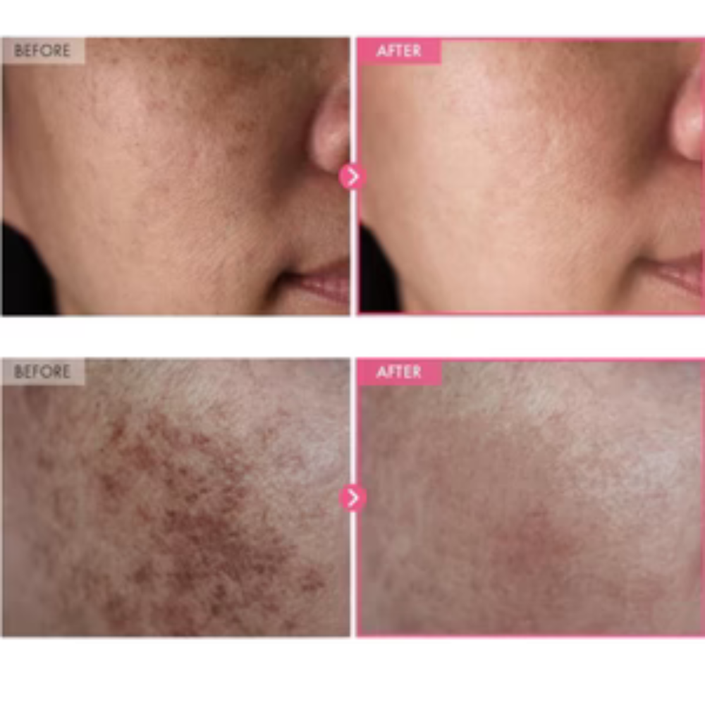 5. Smooths Rough, Dry Texture