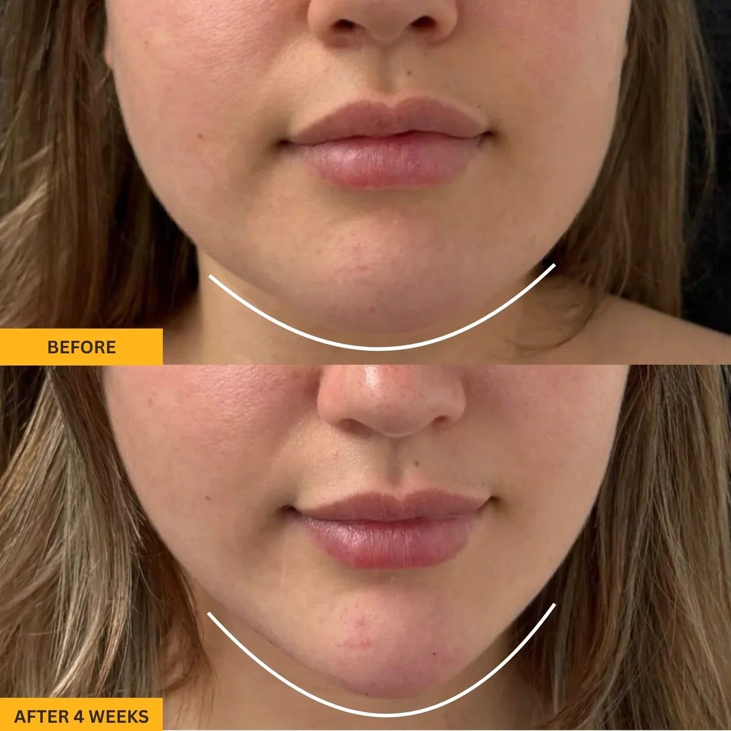 SculptFlow Lymphatic Face Brush