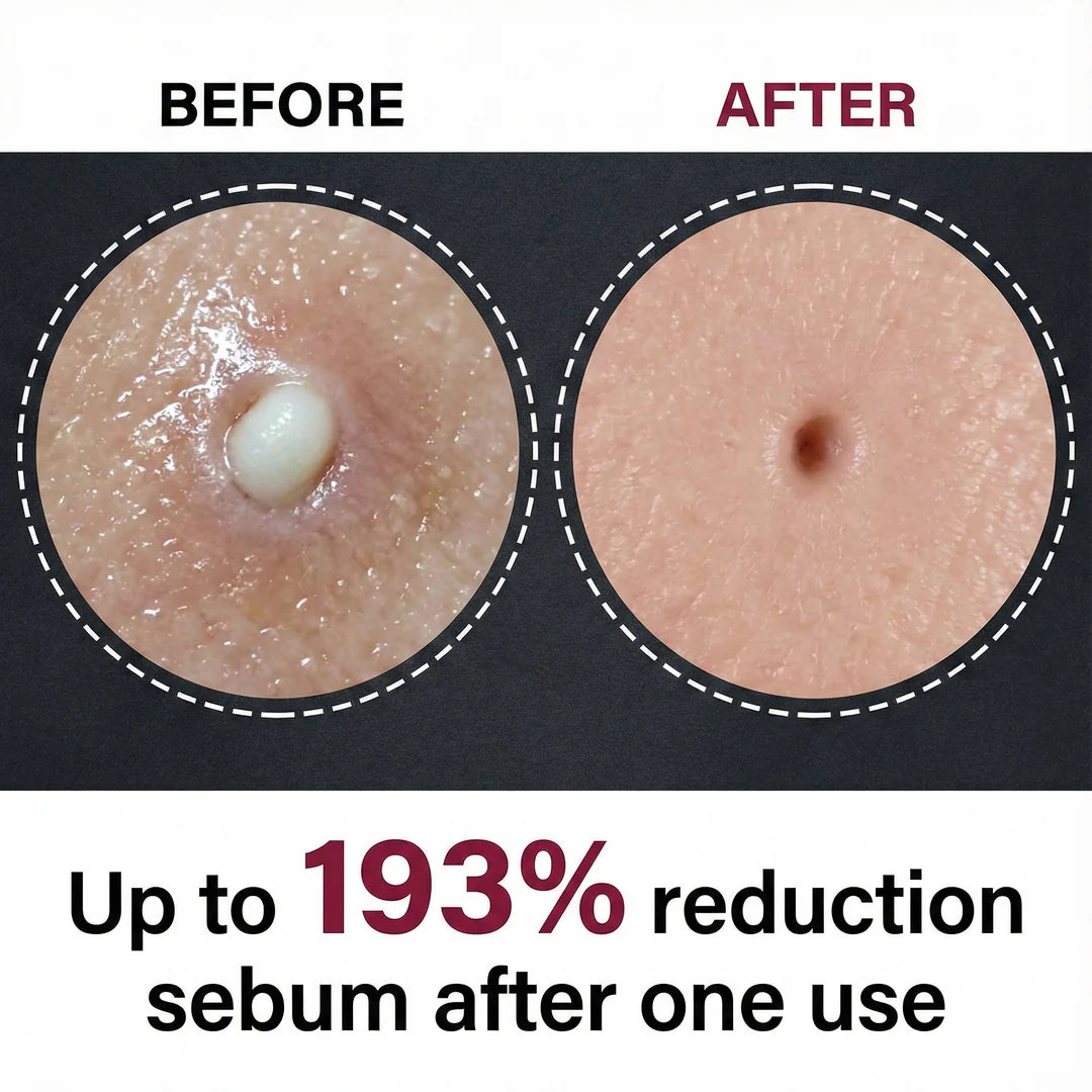 Pure Glow Rice Peel Duo