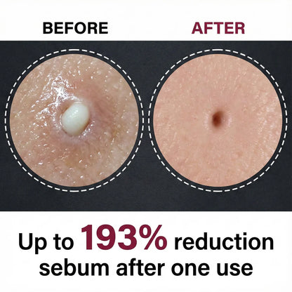 Pure Glow Rice Peel Duo