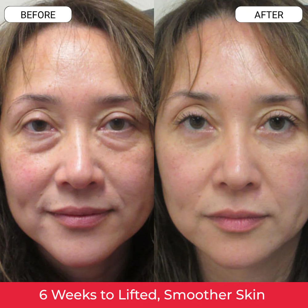 1. Helps Reduce “Tired Looking Skin”