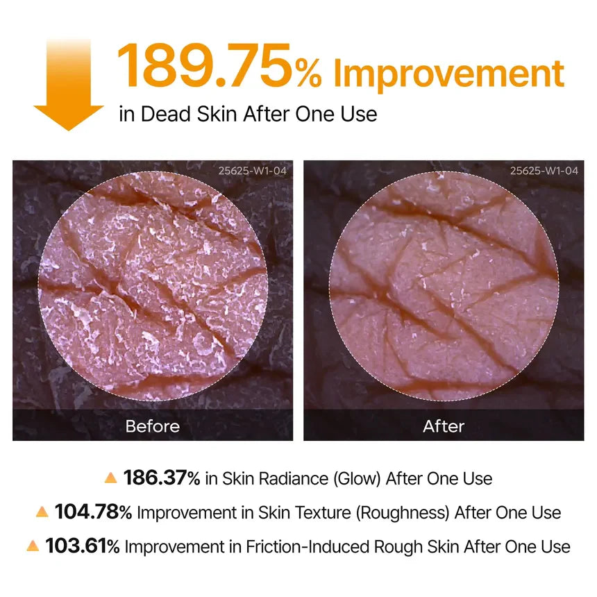 Kojic Turmeric Body Peel Spray