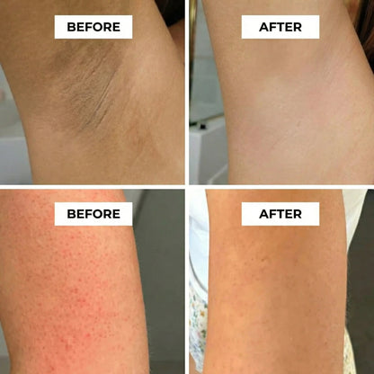 Kojic Turmeric Body Peel Spray