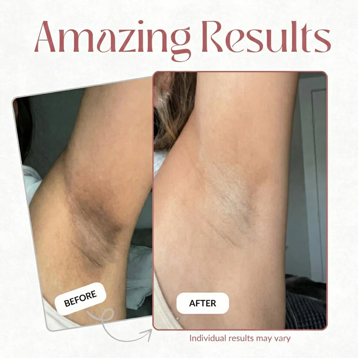 Kojic Turmeric Body Peel Spray