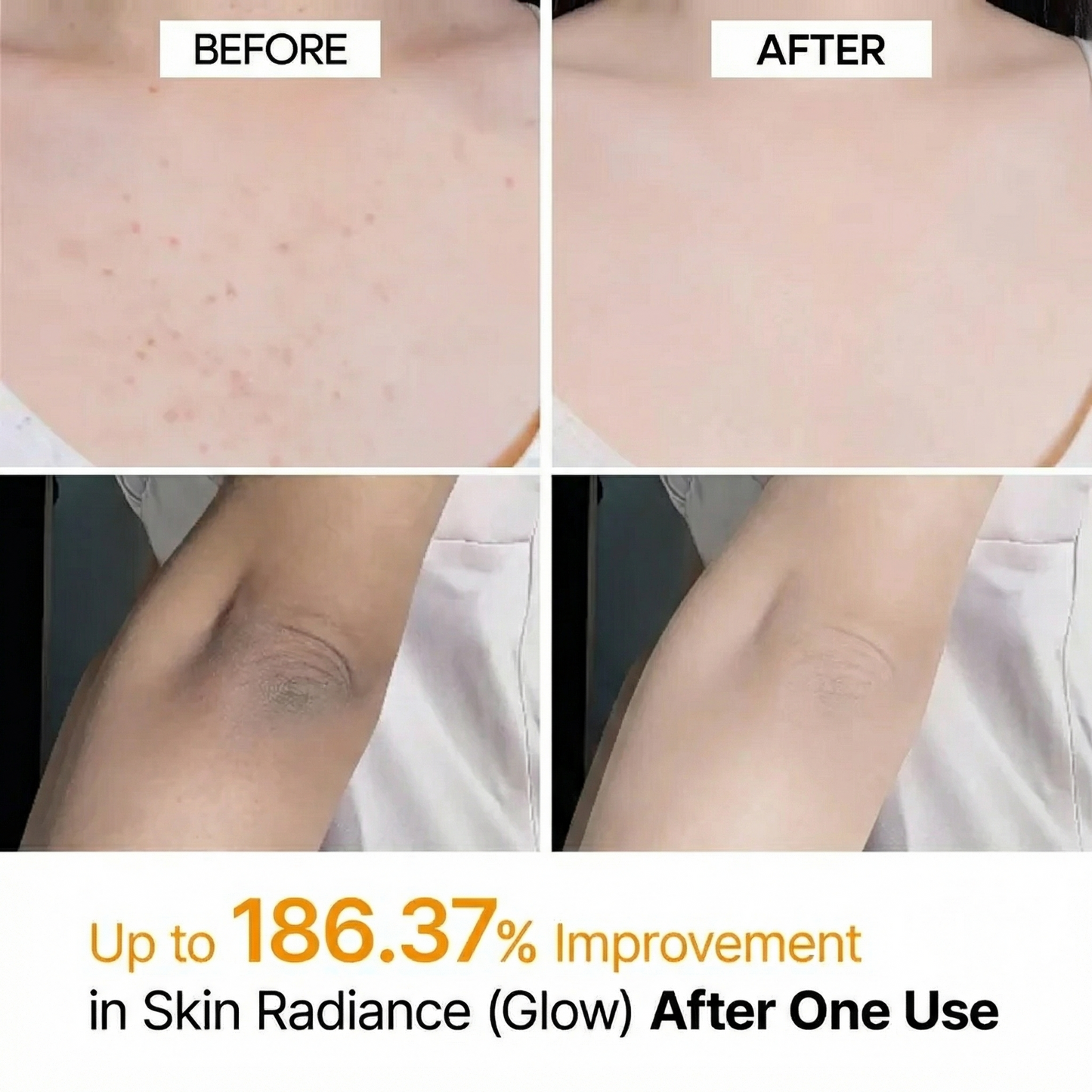 Kojic Turmeric Body Peel Spray