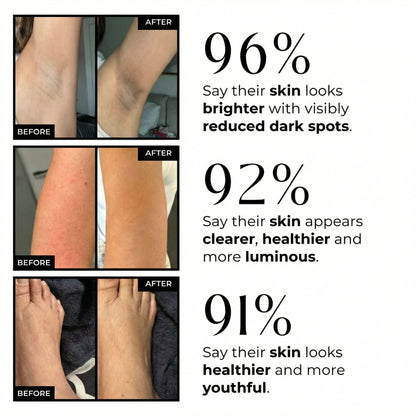 Kojic Turmeric Body Peel Spray