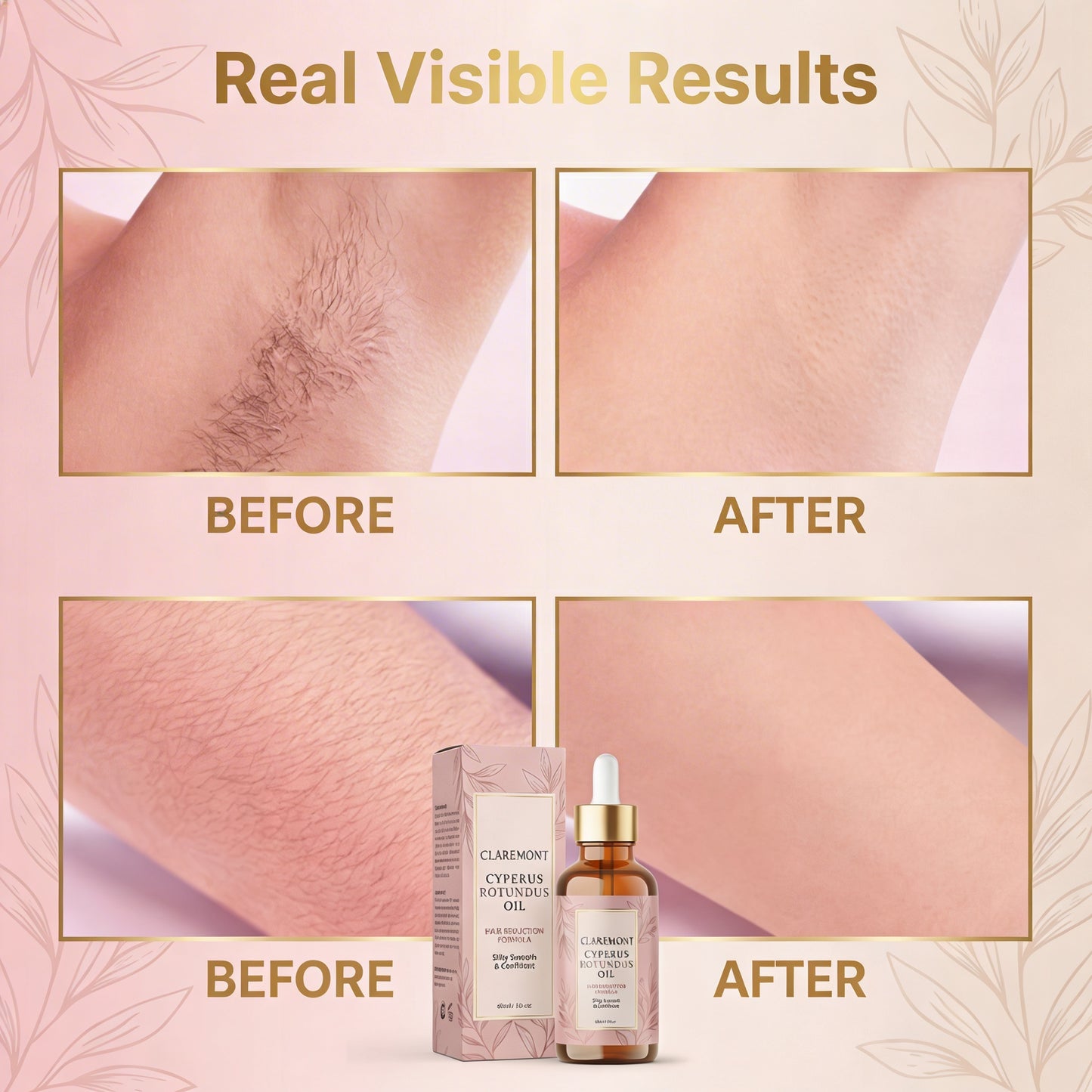 Cyperus Rotundus Oil