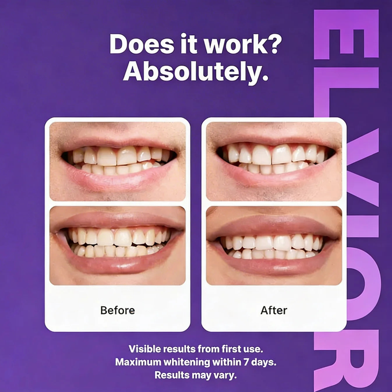 Purple Whitening Strips