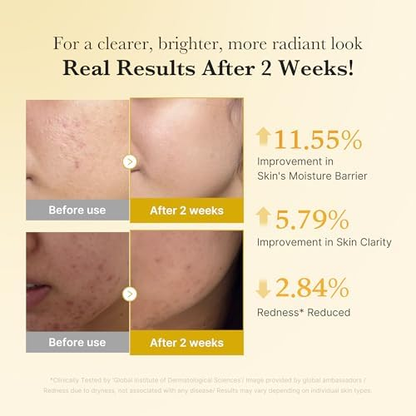 Claremont Kojic Acid Renew & Smooth Duo